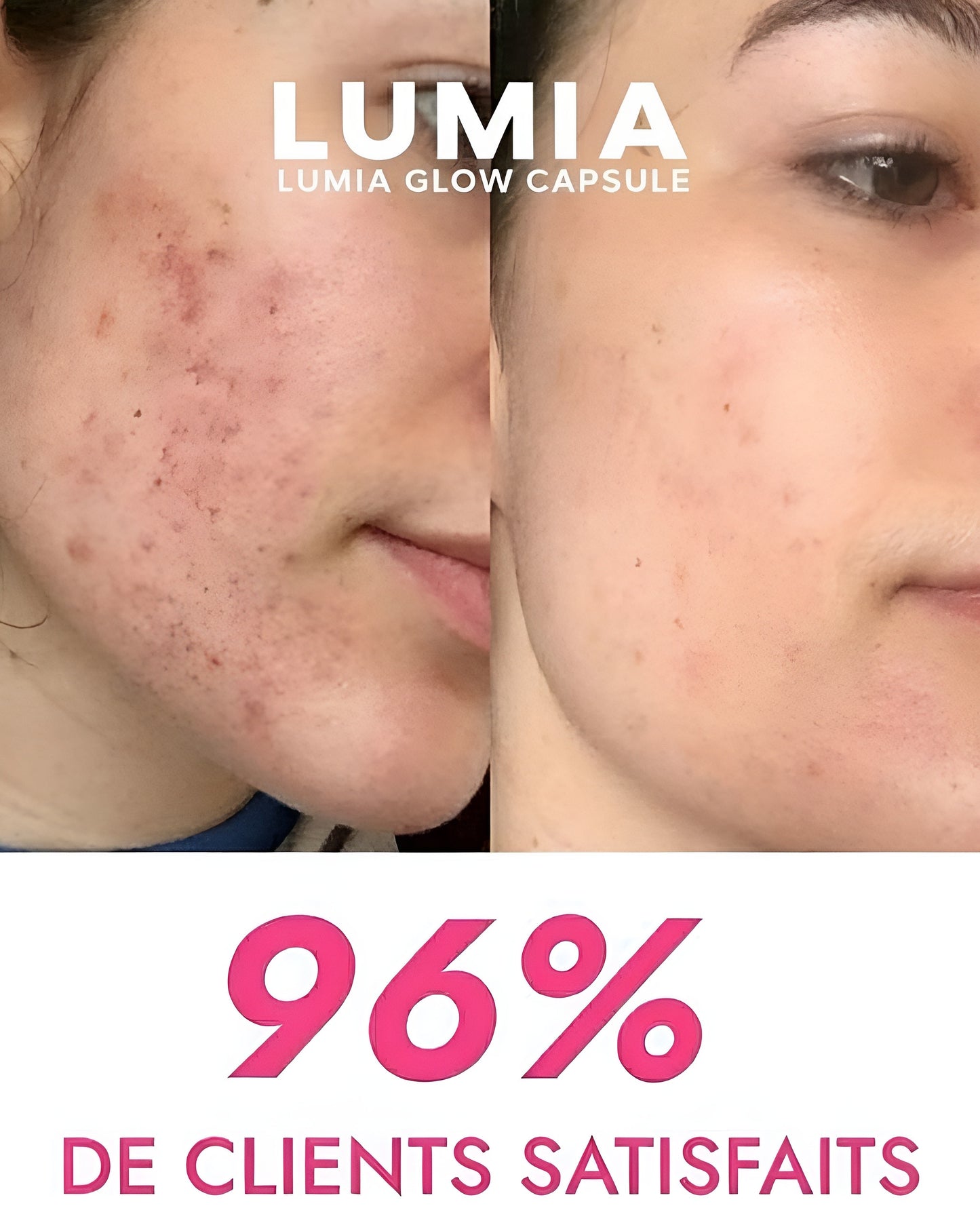 Rouleau à glaçon visage