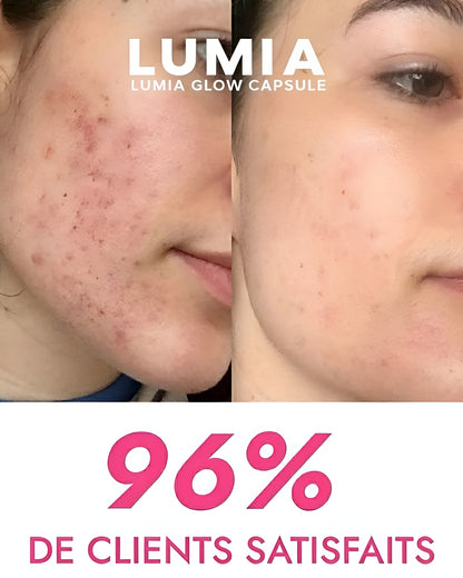 Rouleau à glaçon visage