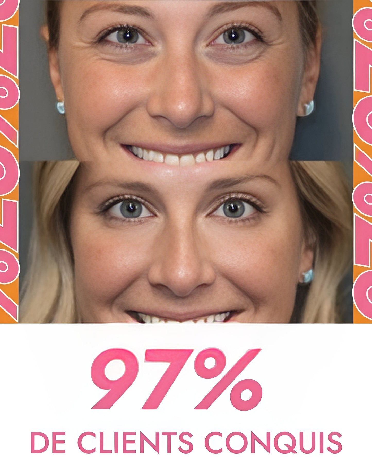 Rouleau à glaçon visage